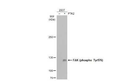 Western Blot: FAK [p Tyr576] Antibody [NBP3-13071]